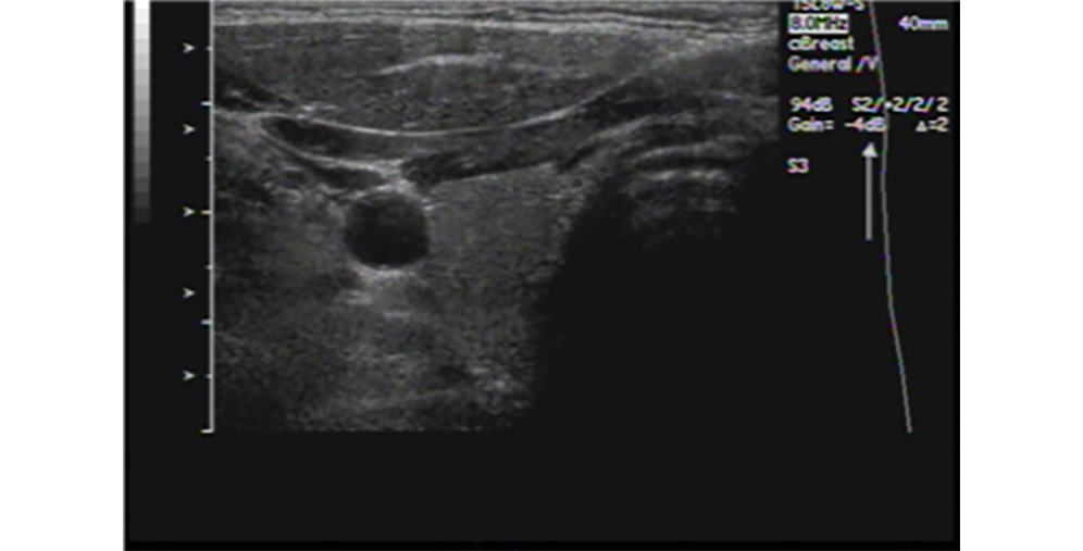 Same probe, same scanner, using Preset 1