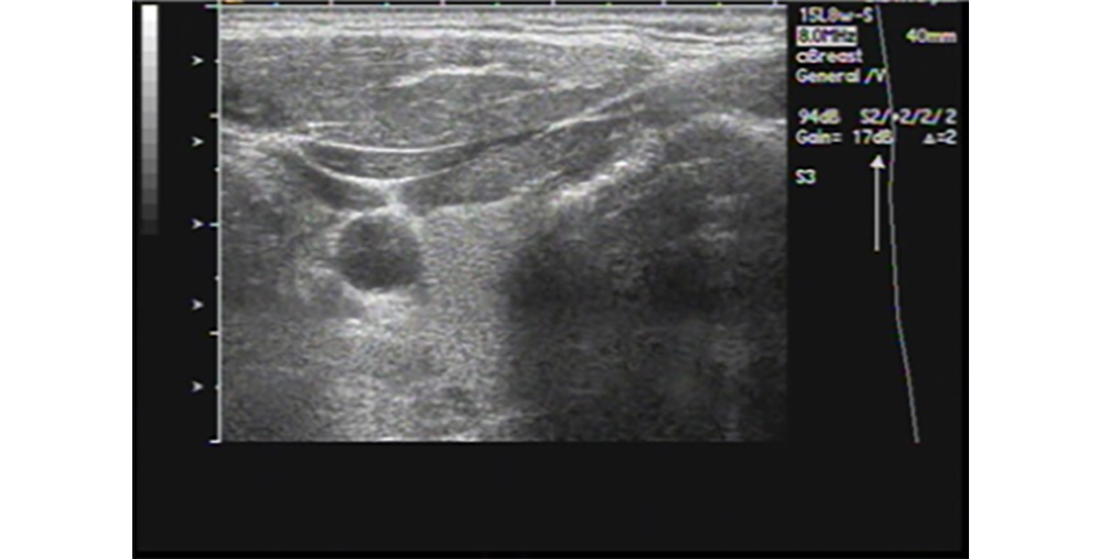Same probe, same scanner, using Preset 2