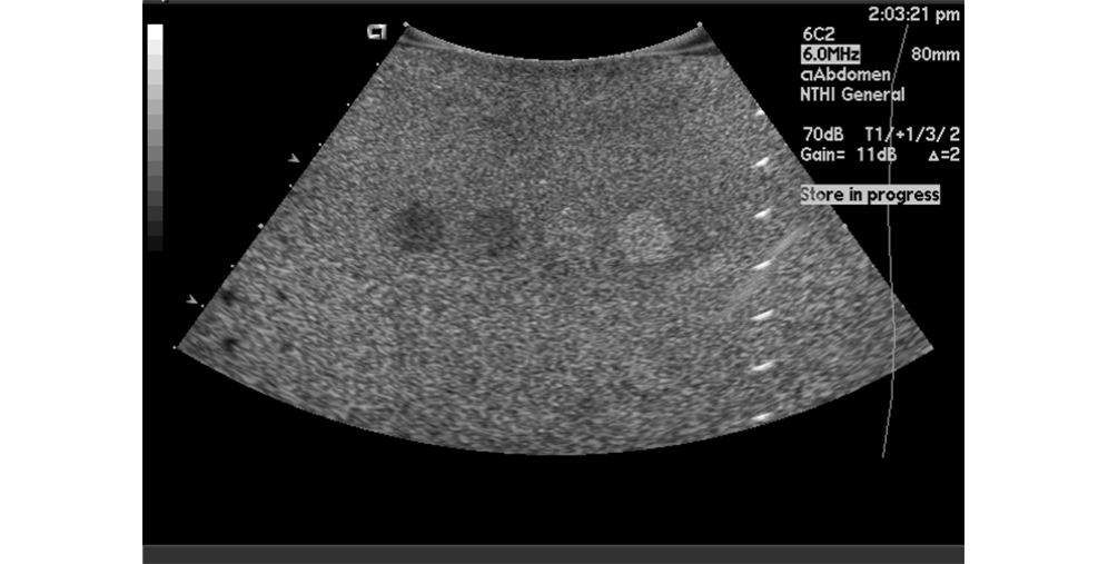 Overall image uniformity showing consistent background shading