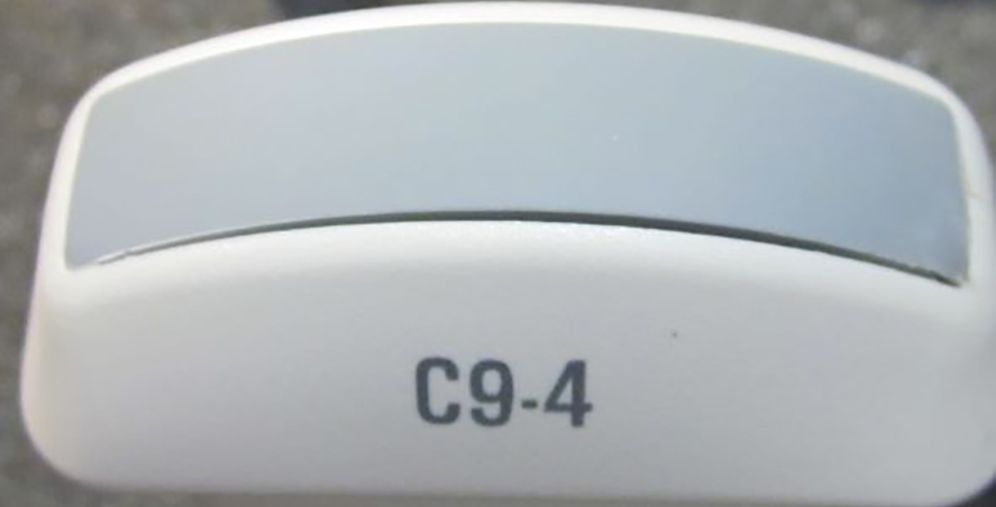 Degraded seal on an ultrasound probe lens