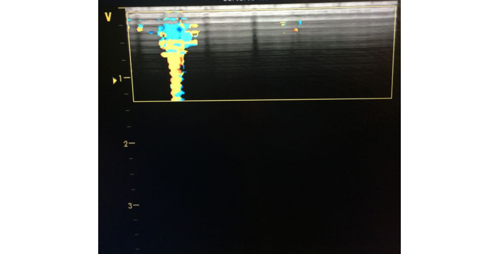 Color artifact due to wiring failure