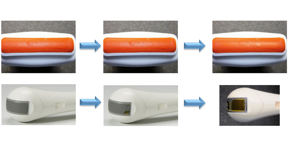 Acoustic lenses in various stages of wear