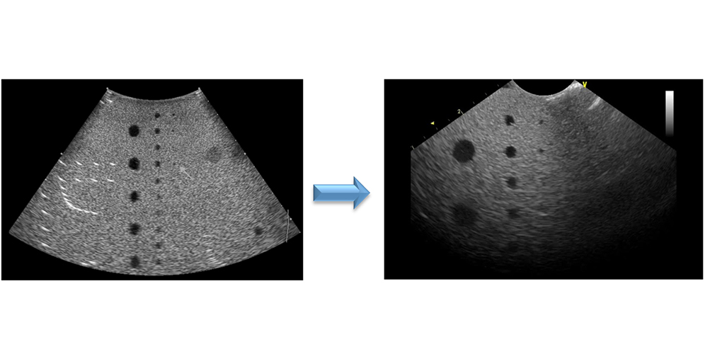 Potential effects of a damaged lens when testing image uniformity using a phantom
