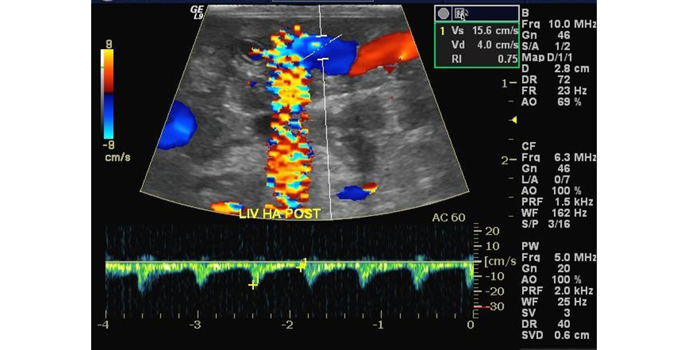 ultrasound image